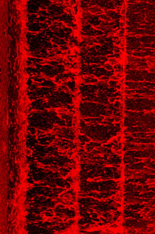 water blood by: Jake the Snake